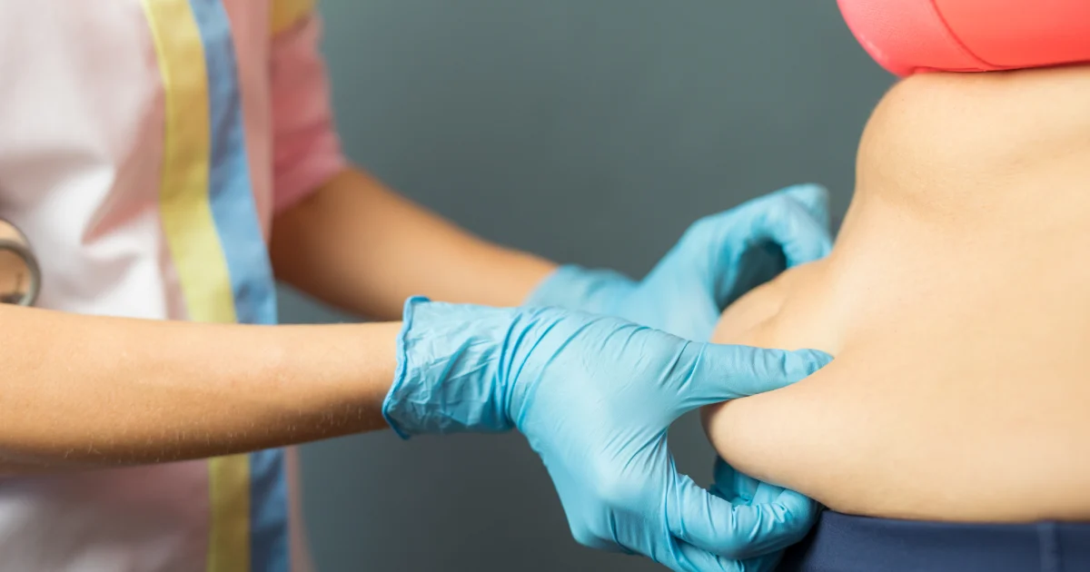 Doctor examining the abdominal area before a mommy makeover in Wake Forest, NC, body contouring procedure